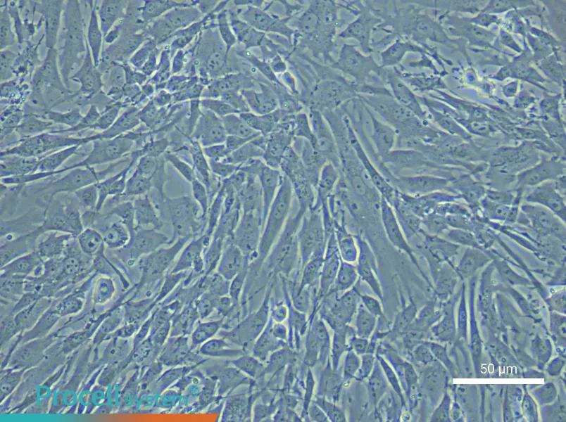 Mouse Pulmonary Great Artery Smooth Muscle Cell Complete Medium - small - 4