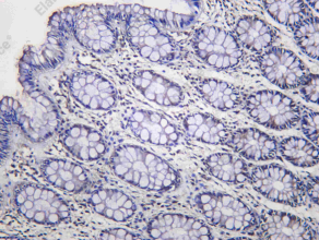 Recombinant SIRT2 Monoclonal Antibody - 1