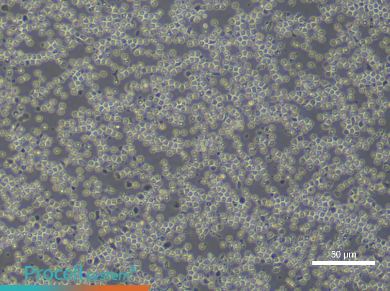 Human Peripheral Blood Mononuclear Cell Complete Medium - 6