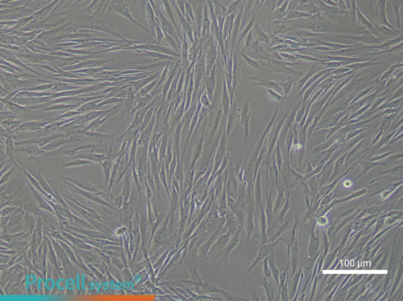 Human Endometrial Stromal Cell Complete MediumHuman Endometrial Stromal Cell Complete Medium - 2