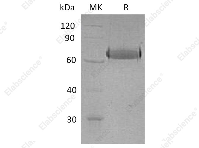 Recombinant Human EphA2 Protein (His Tag) - 1