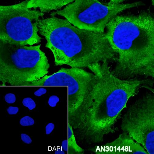 Recombinant BMP6 Monoclonal Antibody - 2