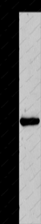 MMP13 Polyclonal Antibody - 1