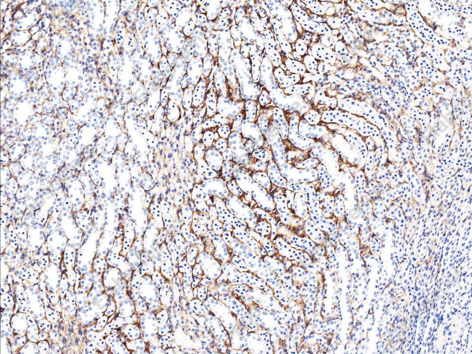 Recombinant Endoglin/CD105 Monoclonal Antibody - 2