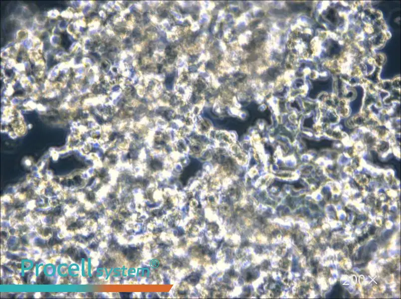 NCI-H526 Cell Complete Medium - 4