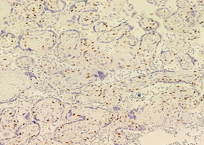 PARP/PARP1 Monoclonal Antibody - small - 2