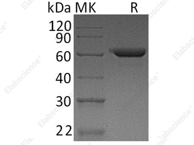 Recombinant Human Fibronectin/FN Protein - 1