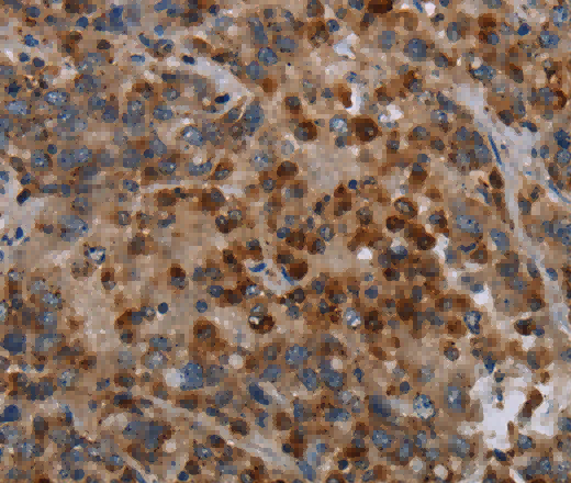 MAP3K11 Polyclonal Antibody - 3