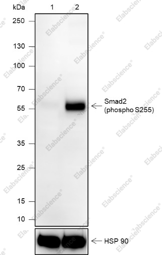 Recombinant Phospho-Smad2 (S255) Monoclonal Antibody - 1