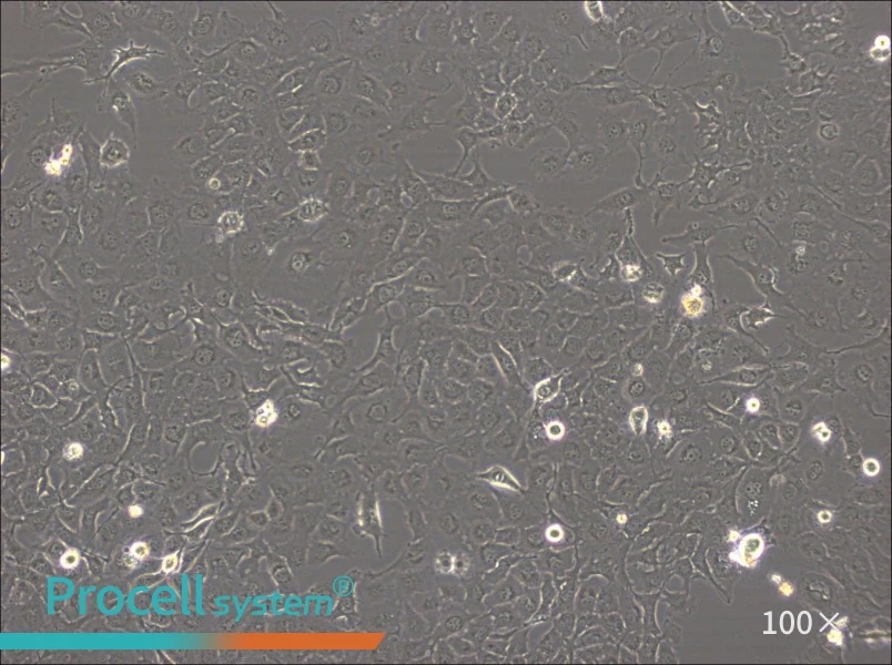BT-549 Cell Complete Medium - 2