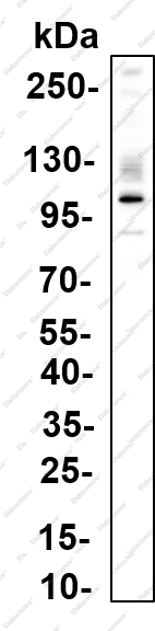 Recombinant IRE1α (Phospho Ser724) Monoclonal Antibody - 1