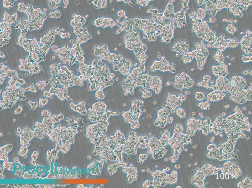 ZR-75-1 Cell Complete Medium - 1