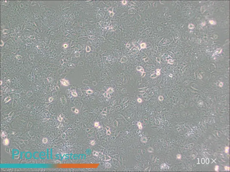 KYSE-30 Cell Complete Medium - 3