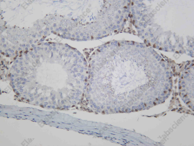 Recombinant MBD2 Monoclonal Antibody - 3