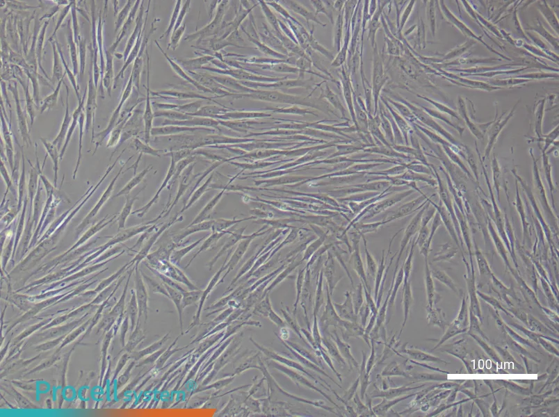 Human Skeletal Muscle Fibroblast Complete Medium - 1