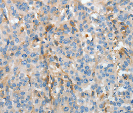 APOH Polyclonal Antibody - 3