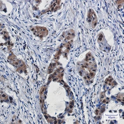 Recombinant RBX1 Monoclonal Antibody - 1