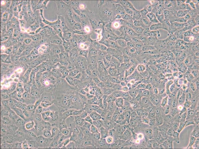 B-CPAP [BC-PAP; BCPAP] Cell Complete Medium - small - 5