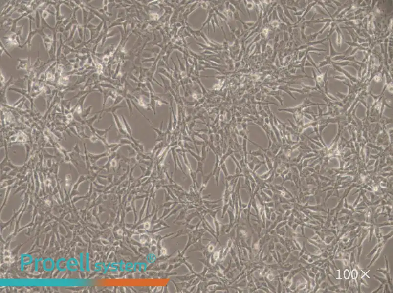 ES-2 Cell Complete Medium - 1