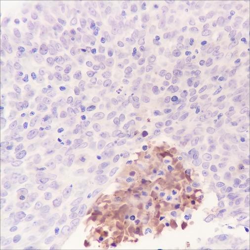 Recombinant Tenascin X Monoclonal Antibody-searchlist-1