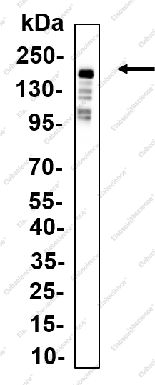 Recombinant GLI-1 Monoclonal Antibody - 1
