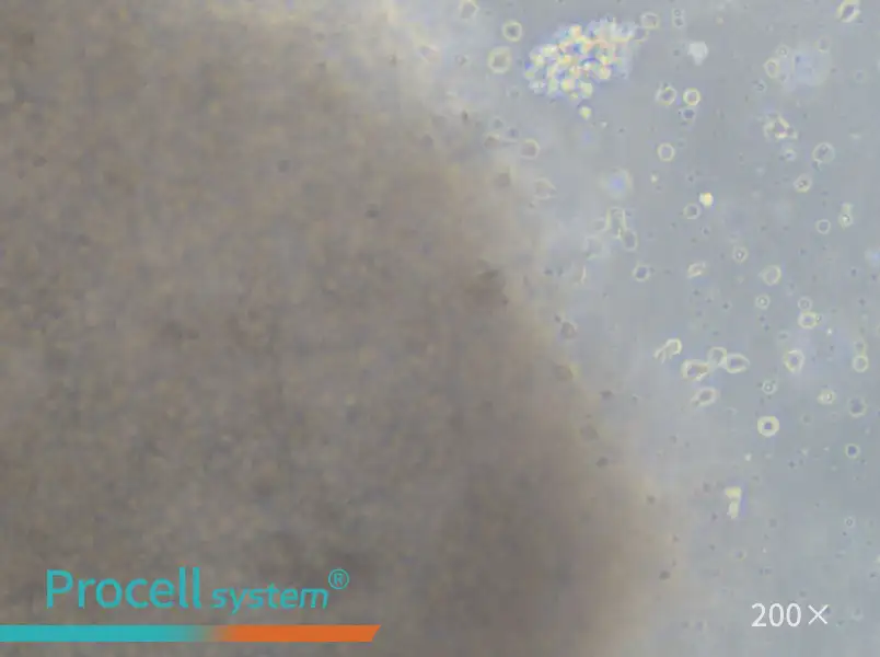 GM23687 Cell Complete Medium - 4