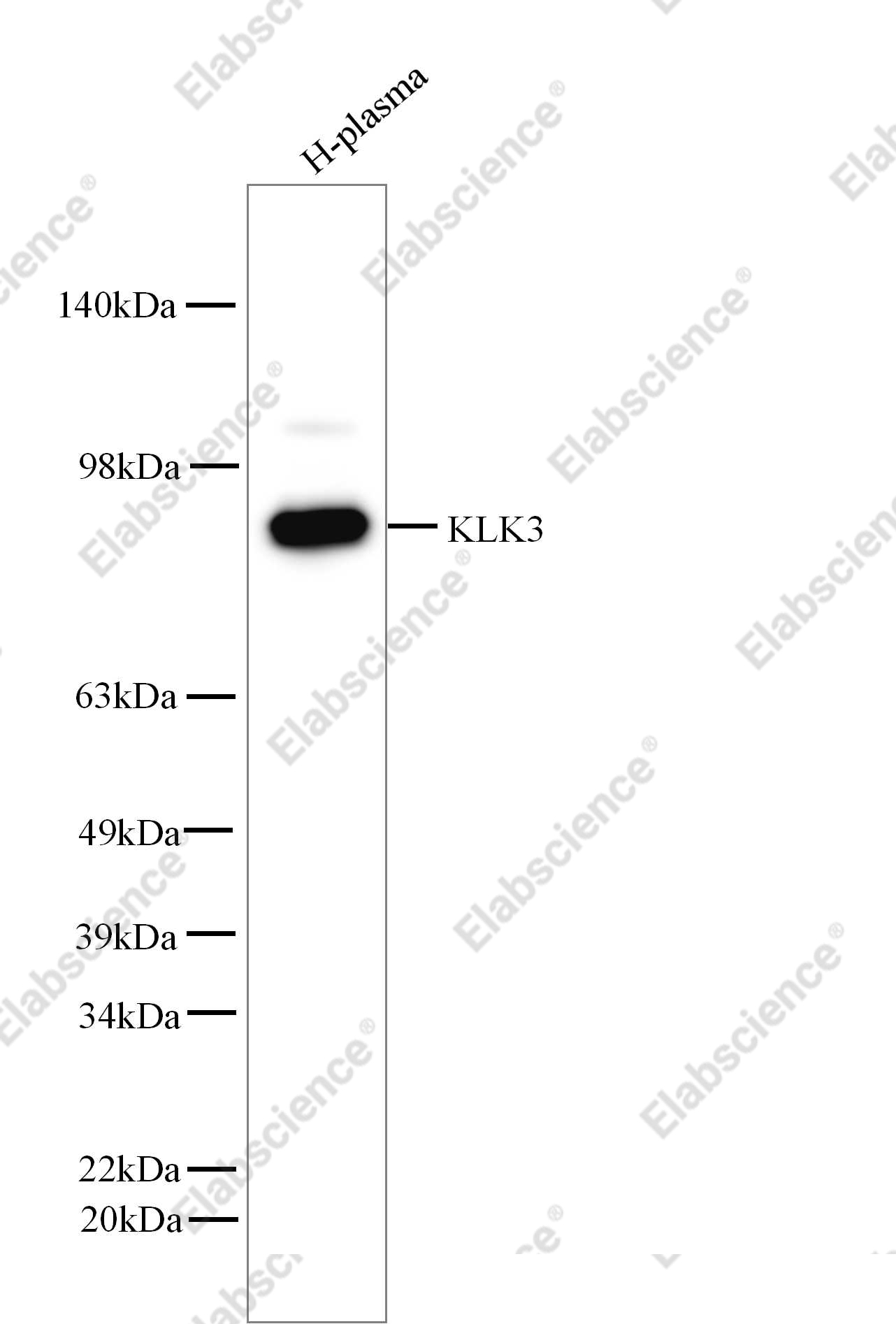 Recombinant KLK3/Kallikrein 3 Monoclonal Antibody - 1