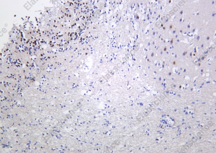Recombinant Fos B Monoclonal Antibody - 1
