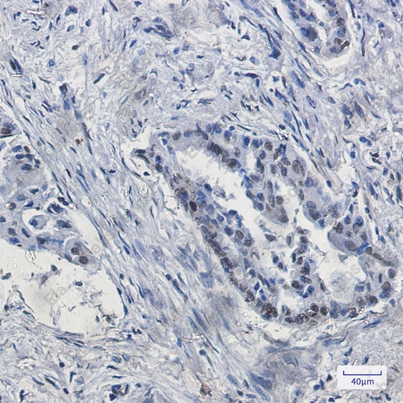 Recombinant KDM4B/JMJD2B Monoclonal Antibody - 4