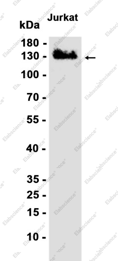 Recombinant FBXL11 Monoclonal Antibody - 1