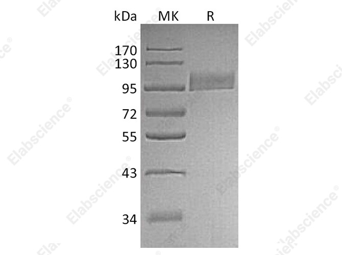 Recombinant Human CD10/Neprilysin Protein (His Tag) - 1
