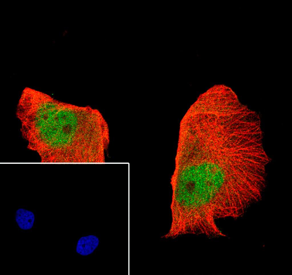 Recombinant MCM7 Monoclonal Antibody-searchlist-2