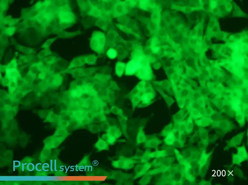 Panc02-GFP - 5