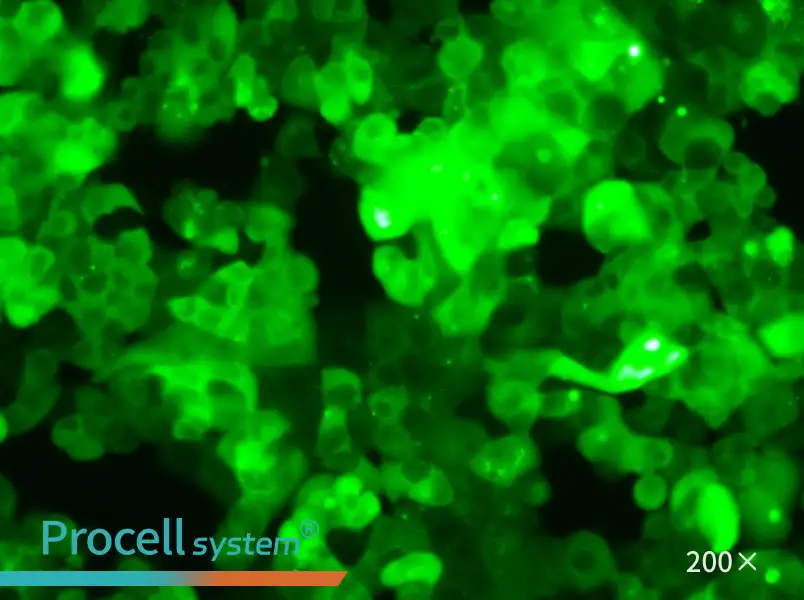 MCF-7-GFP Cell Complete Medium - small - 5