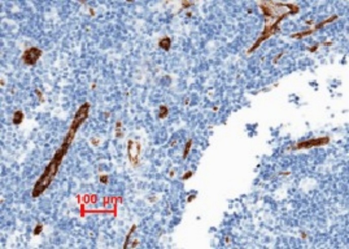 Recombinant vWF Monoclonal Antibody - small - 4
