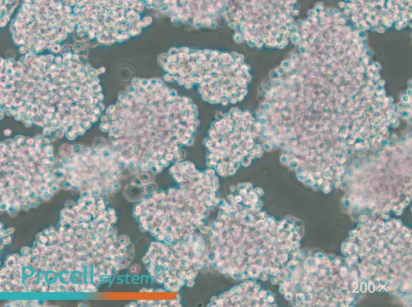 HuT 102 Cell Complete Medium - 5