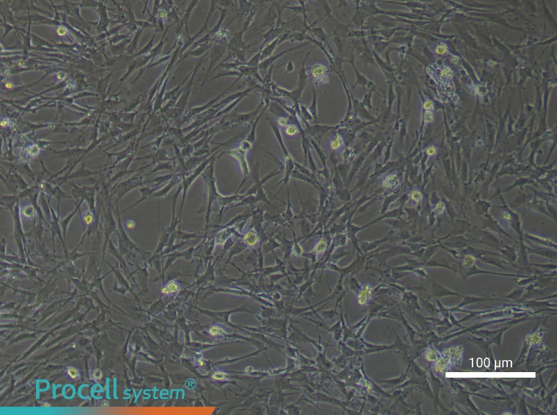 Rat Brain Fibroblast Complete Medium - 1