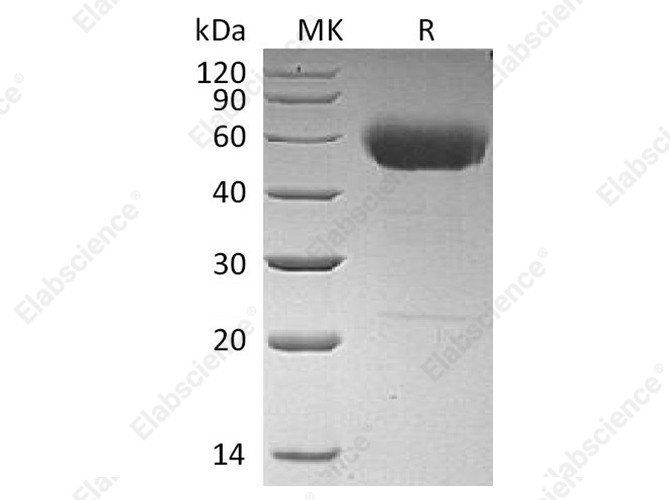 Recombinant Human Interleukin-22/IL-22 Protein (C-hIgG2 Fc) - 1