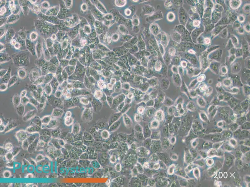 NPC/HK1 Cell Complete Medium - small - 5