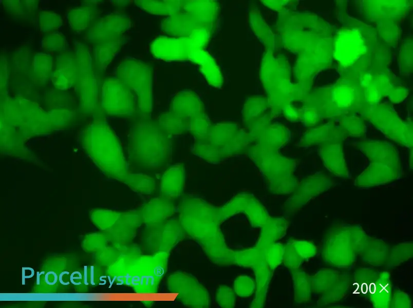 NCI-H446-LUC-EGFP Cell Complete Medium - 4