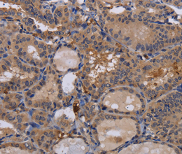 FADS1 Polyclonal Antibody - 3
