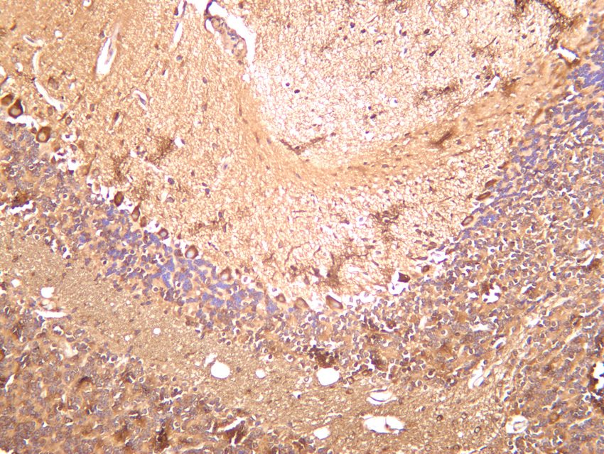 Recombinant LC3B Monoclonal Antibody - 3