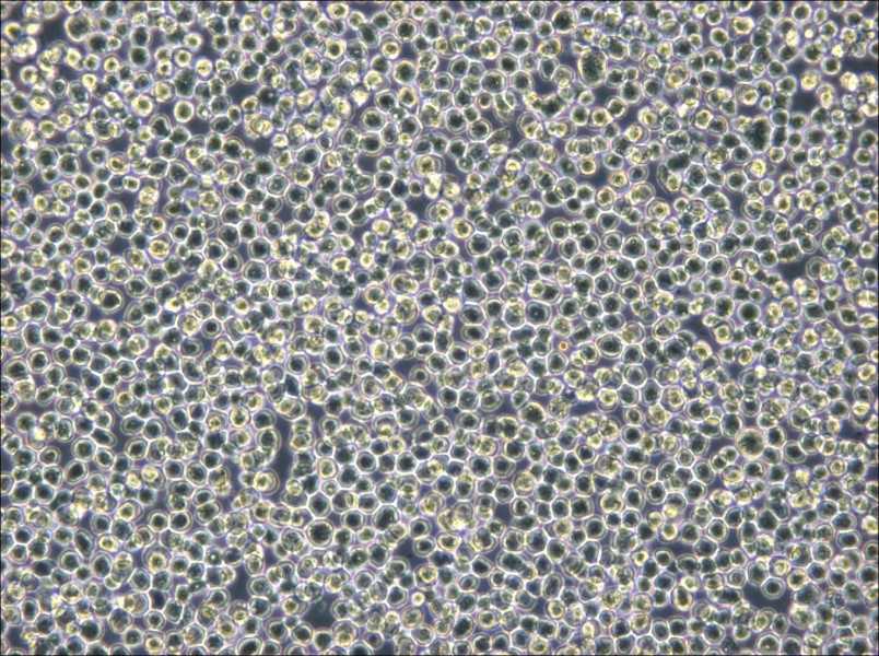 NB4 Cell Complete Medium - 6