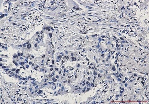 Recombinant HIF1 beta Monoclonal Antibody - 3