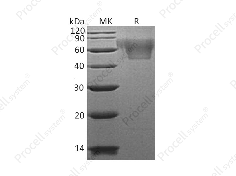 Fractalkine/CX3CL1 (C-6His), Human, Recombinant