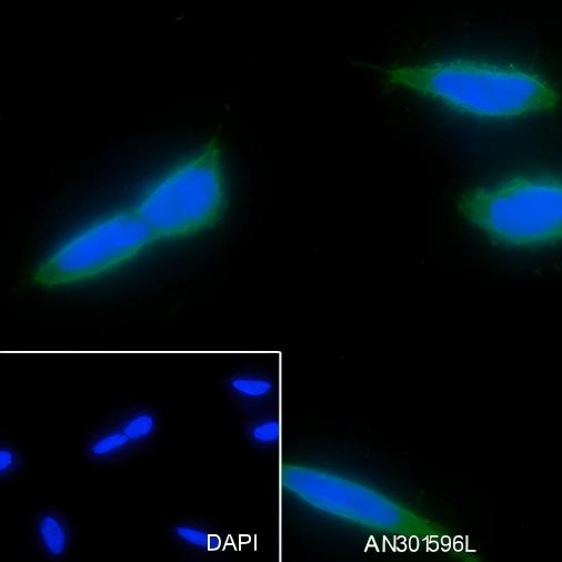 Recombinant MAP1LC3A Monoclonal Antibody - small - 3