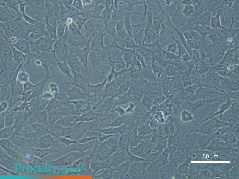 Human Chondrocyte (Primary cell immortalization) Complete Medium - 6