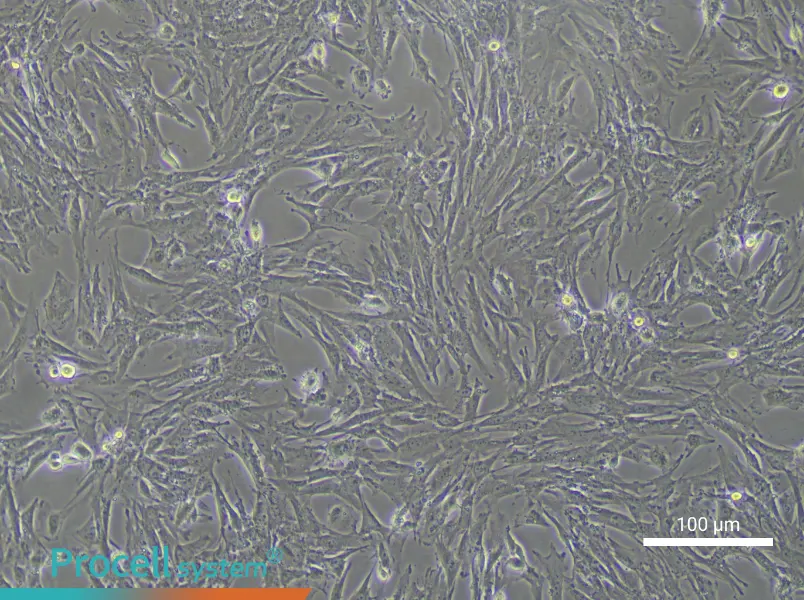 Mouse Pulmonary Artery Smooth Muscle Cell Complete Medium - 2