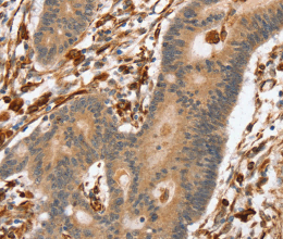 SSX2IP Polyclonal Antibody - 3