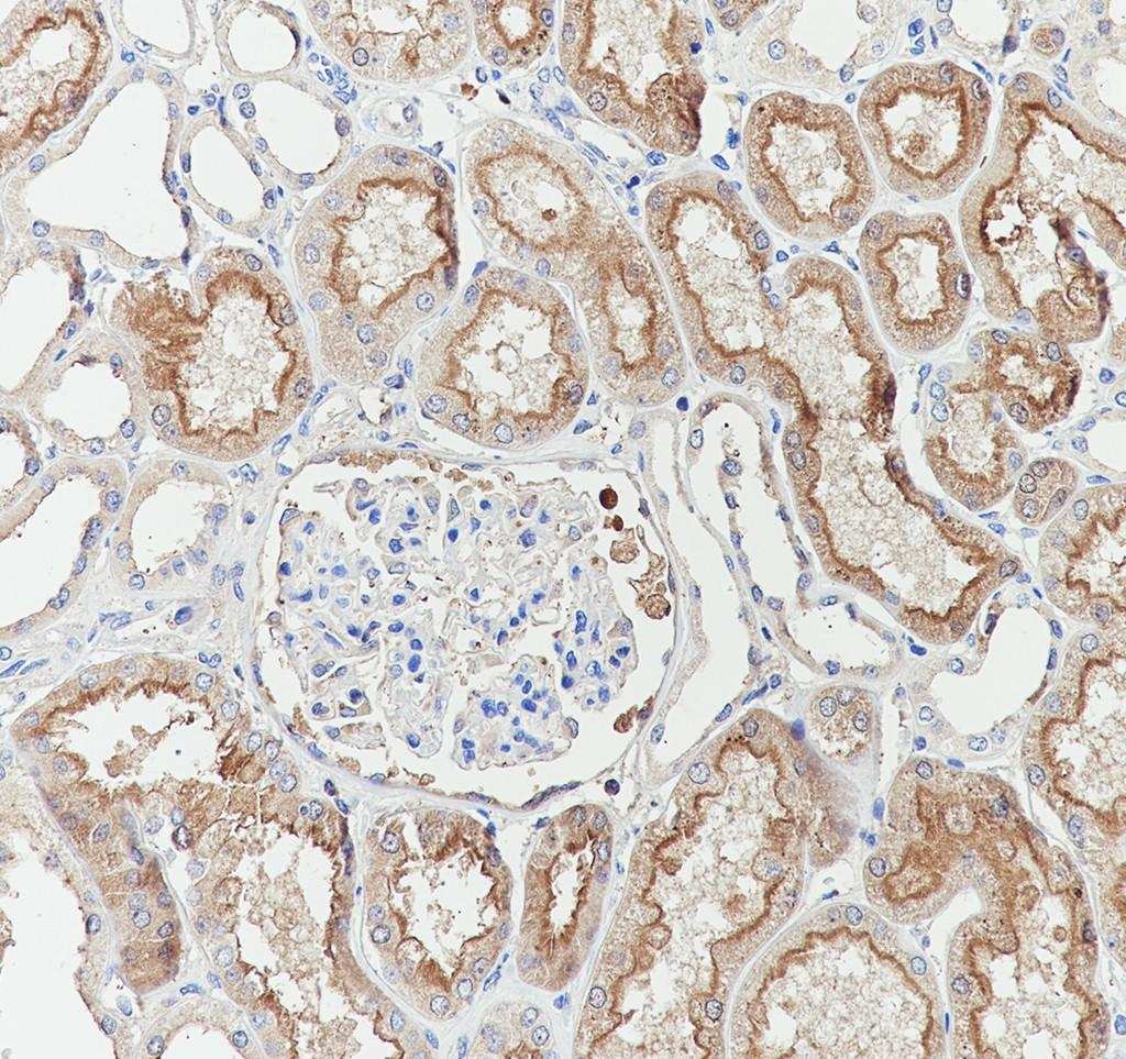 Recombinant EAAT3 Monoclonal Antibody-searchlist-2